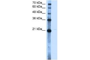 WB Suggested Anti-OLR1 Antibody Titration:  2. (OLR1 anticorps  (N-Term))