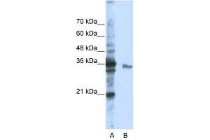 EXOSC3 antibody used at 1 ug/ml to detect target protein. (EXOSC3 anticorps  (Middle Region))