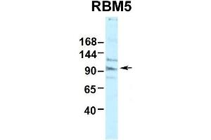 Human HepG2 (RBM5 anticorps  (N-Term))
