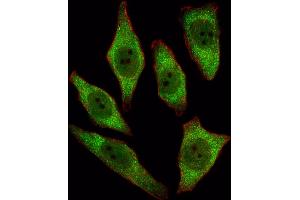 Fluorescent image of A549 cell stained with RT Antibody (N-term) 2893a/SA091009AF. (APRT anticorps  (N-Term))