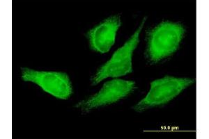 Immunofluorescence of purified MaxPab antibody to EEF1G on HeLa cell.
