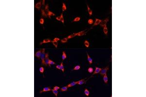 Immunofluorescence analysis of NIH/3T3 cells using CHAT antibody (ABIN6131569, ABIN6138488, ABIN6138490 and ABIN6217173) at dilution of 1:100.