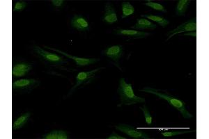 Immunofluorescence of purified MaxPab antibody to PPP2CB on HeLa cell. (PPP2CB anticorps  (AA 1-309))
