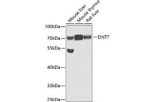 Western blot analysis of extracts of various cell lines using DNTT Polyclonal Antibody at dilution of 1:1000. (TdT anticorps)