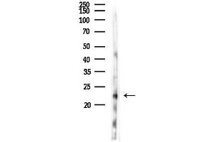 anti-ADP-Ribosylation Factor-Like 4D (ARL4D) antibody