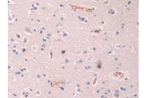 Detection of OAS1 in Human Cerebrum Tissue using Polyclonal Antibody to 2',5'-Oligoadenylate Synthetase 1 (OAS1) (OAS1 anticorps  (AA 74-165))