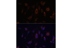 Immunofluorescence analysis of C6 cells using GLRX antibody (ABIN6127980, ABIN6141147, ABIN6141149 and ABIN6220940) at dilution of 1:100.