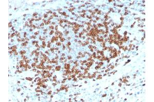 Formalin-fixed, paraffin-embedded human Tonsil stained with CD3e Rabbit Recombinant Monoclonal Antibody (C3e/3125R).