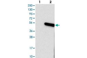 Western blot analysis of Lane 1: Negative control (vector only transfected HEK293T lysate), Lane 2: Over-expression Lysate (Co-expressed with a C-terminal myc-DDK tag (~3. (TMEM130 anticorps)