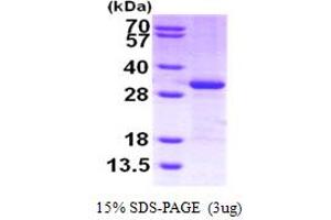 SDS-PAGE (SDS) image for Cbp/p300-Interacting Transactivator, with Glu/Asp-Rich Carboxy-terminal Domain, 2 (CITED2) (AA 1-270) protein (His tag) (ABIN666771)