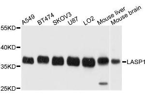 Western blot analysis of extracts of various cell lines, using LASP1 antibody.