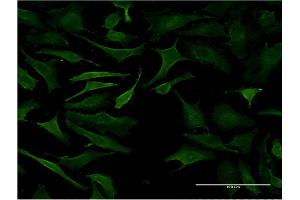 Immunofluorescence of monoclonal antibody to B3GALT2 on HeLa cell.