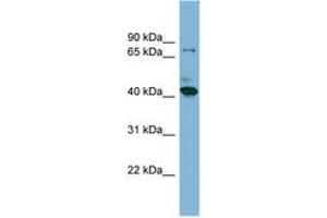HERPUD2 anticorps  (N-Term)