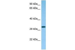 WB Suggested Anti-Capzb Antibody Titration: 1. (CAPZB anticorps  (C-Term))