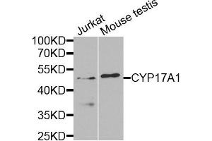 Western blot analysis of extracts of Jurkat and mouse testis cells, using CYP17A1 antibody. (CYP17A1 anticorps)