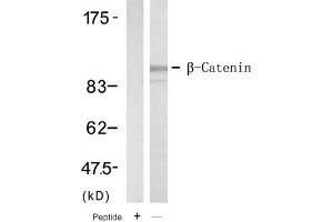 Image no. 1 for anti-Catenin (Cadherin-Associated Protein), beta 1, 88kDa (CTNNB1) (Tyr654) antibody (ABIN319394) (CTNNB1 anticorps  (Tyr654))