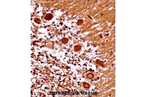 Immunohistochemistry (IHC) image for anti-Mesenchyme Homeobox 1 (MEOX1) antibody (ABIN2998080) (MEOX1 anticorps)