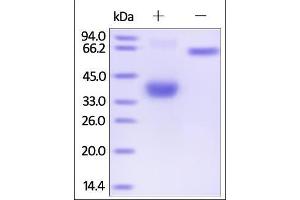 Human BCMA, Fc Tag on SDS-PAGE under reducing (R) and no-reducing (NR) conditions.
