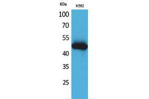 Western Blotting (WB) image for anti-Interleukin 5 Receptor, alpha (IL5RA) (N-Term) antibody (ABIN3187749) (IL5RA anticorps  (N-Term))