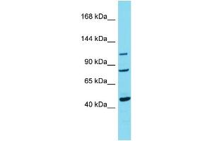 Host:  Rabbit  Target Name:  TRPC7  Sample Type:  Breast Tumor lysates  Antibody Dilution:  1.