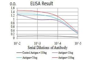 Black line: Control Antigen (100 ng),Purple line: Antigen (10 ng), Blue line: Antigen (50 ng), Red line:Antigen (100 ng)