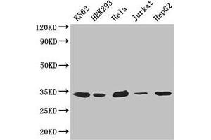 Western Blot Positive WB detected in: K562 whole cell lysate, HEK293 whole cell lysate, Hela whole cell lysate, Jurkat whole cell lysate, HepG2 whole cell lysate All lanes: CDK2 antibody at 2. (CDK2 anticorps  (AA 1-298))