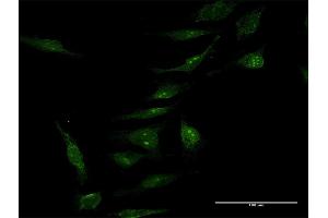 Immunofluorescence of purified MaxPab antibody to MINA on HeLa cell. (MINA anticorps  (AA 1-465))