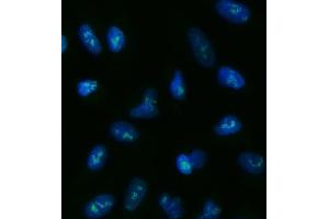 IF analysis of TOX2 using anti-TOX2 antibody (ABIN7601667). (TOX2 anticorps  (AA 41-425))