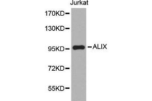 Western blot analysis of extracts of Jurkat cell line, using ALIX antibody. (ALIX anticorps  (AA 1-180))