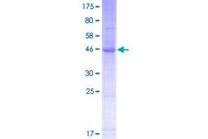 Image no. 1 for Lipoma HMGIC Fusion Partner-Like 4 (LHFPL4) (AA 1-247) protein (GST tag) (ABIN1309366)