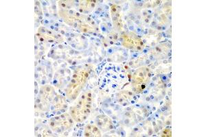 Immunohistochemistry of paraffin-embedded mouse kidney using ADAD1 antibody (ABIN5975411) at dilution of 1/200 (40x lens). (ADAD1 anticorps)