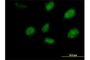 Immunofluorescence of purified MaxPab antibody to PEPP-2 on HeLa cell. (RHOXF2 anticorps  (AA 1-288))