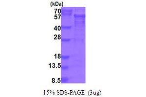 SDS-PAGE (SDS) image for Protein Interacting With Protein Kinase C, alpha 1 (PICK1) (AA 1-415) protein (His tag) (ABIN5854029) (PICK1 Protein (AA 1-415) (His tag))