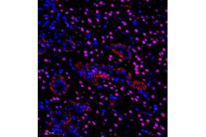 Immunofluorescence of paraffin embedded rat kidney using pax2 (ABIN7074974) at dilution of 1:600 (350x lens)