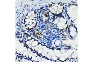 Immunohistochemistry of paraffin-embedded mouse colon using S Rabbit mAb (ABIN7270152) at dilution of 1:100 (40x lens). (SATB2 anticorps)