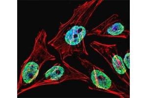 Fluorescent confocal image of HeLa cell stained with TERT antibody at 1:25.