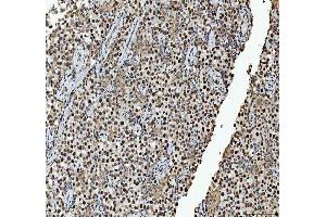 IHC analysis of hnRNP L/HNRNPL using anti-hnRNP L/HNRNPL antibody (ABIN7600130). (HNRNPL anticorps  (AA 152-569))