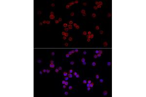 Immunofluorescence analysis of K-562 cells using NF Rabbit pAb (ABIN6130595, ABIN6144558, ABIN6144559 and ABIN6222368) at dilution of 1:50 (40x lens). (NFATC3 anticorps  (AA 1-290))