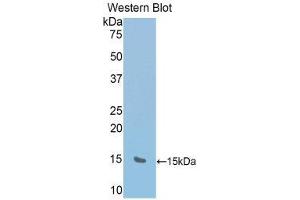 Western Blotting (WB) image for anti-RalA Binding Protein 1 (RALBP1) (AA 527-626) antibody (ABIN1176613)
