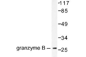 Image no. 1 for anti-Granzyme B (GZMB) antibody (ABIN265445) (GZMB anticorps)