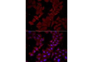 Immunofluorescence analysis of HeLa cells using CCT4 antibody (ABIN5973931). (CCT4 anticorps)