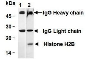 Western Blotting (WB) image for anti-Histone H2B antibody (ABIN1107547) (Histone H2B anticorps)
