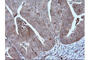 Image no. 5 for anti-Mitogen-Activated Protein Kinase Kinase 1 (MAP2K1) antibody (ABIN1499381)