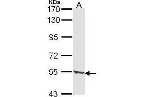 WB Image Sample (30 ug of whole cell lysate) A: A431 , 7.