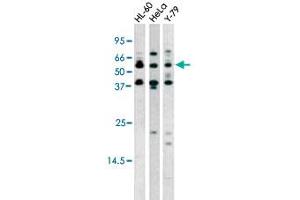 The RAD9A (phospho S272) polyclonal antibody  is used in Western blot to detect Phospho-RAD9A-S272 in HL-60 (left), Hela (middle), and Y-79 (right) cell lysates. (RAD9A anticorps  (pSer272))