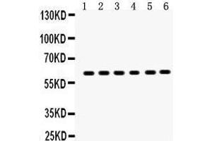 Anti-EAAT2 antibody, Western blotting All lanes: Anti EAAT2  at 0. (SLC1A2 anticorps  (AA 461-574))