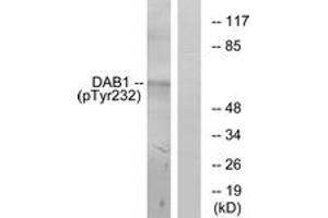 Western Blotting (WB) image for anti-Disabled Homolog 1 (Drosophila) (DAB1) (pTyr232) antibody (ABIN2888392) (DAB1 anticorps  (pTyr232))