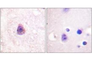 Immunohistochemistry analysis of paraffin-embedded human brain tissue, using Arrestin 1 (Ab-412) Antibody.