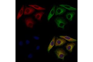 ABIN7094746 and ABIN7098797 staining Hela cells by IF/ICC.