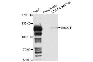 Immunoprecipitation analysis of 150ug extracts of 293T cells using 3ug ERCC4 antibody. (ERCC4 anticorps  (AA 600-700))